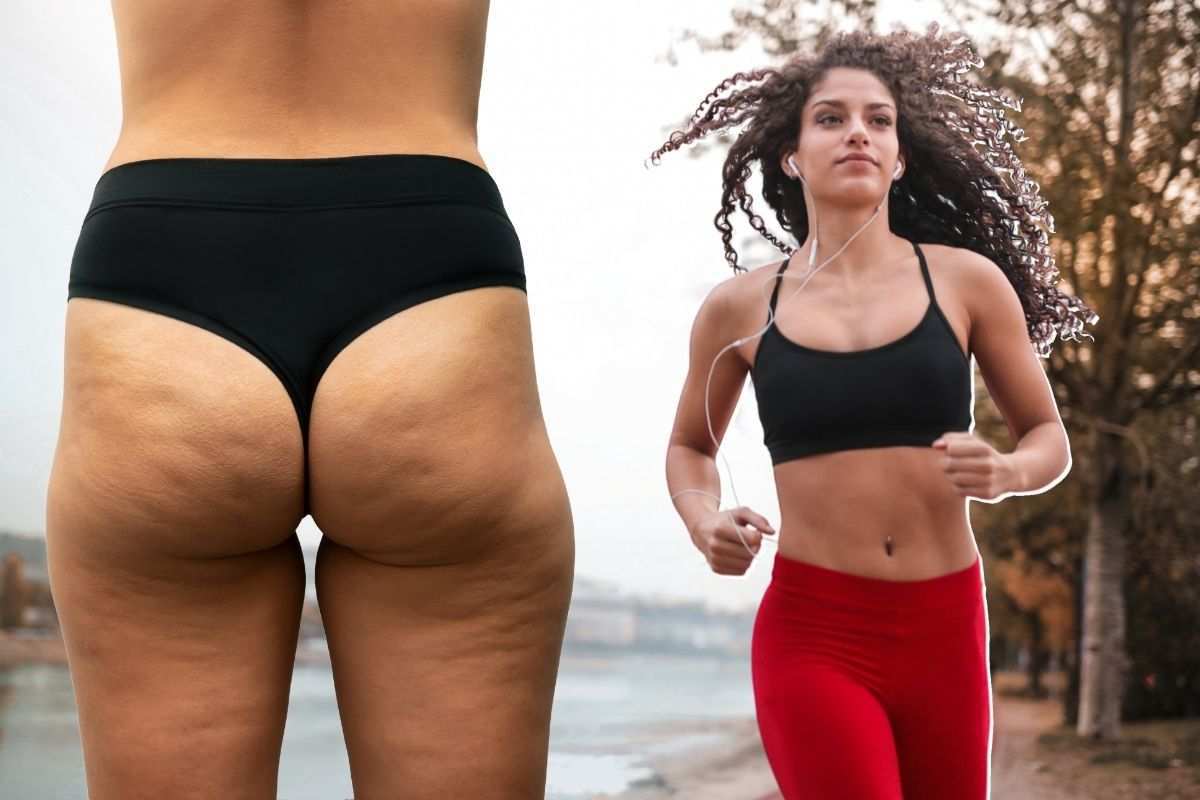 così la cellulite peggiora