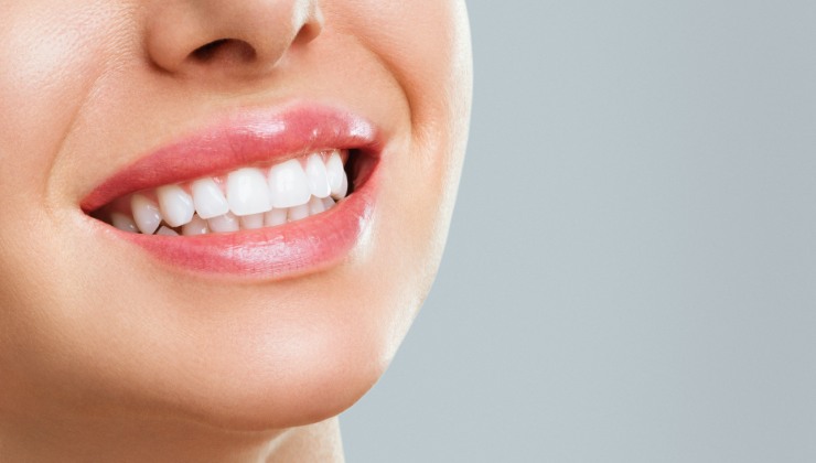 Sbiancare denti in modo naturale: i trucchi da seguire