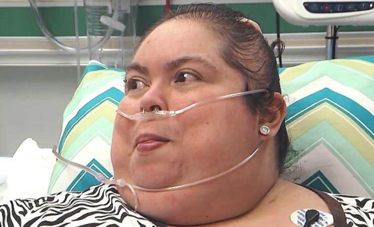 Cindy Vela, la paziente del dottor nowzaradan