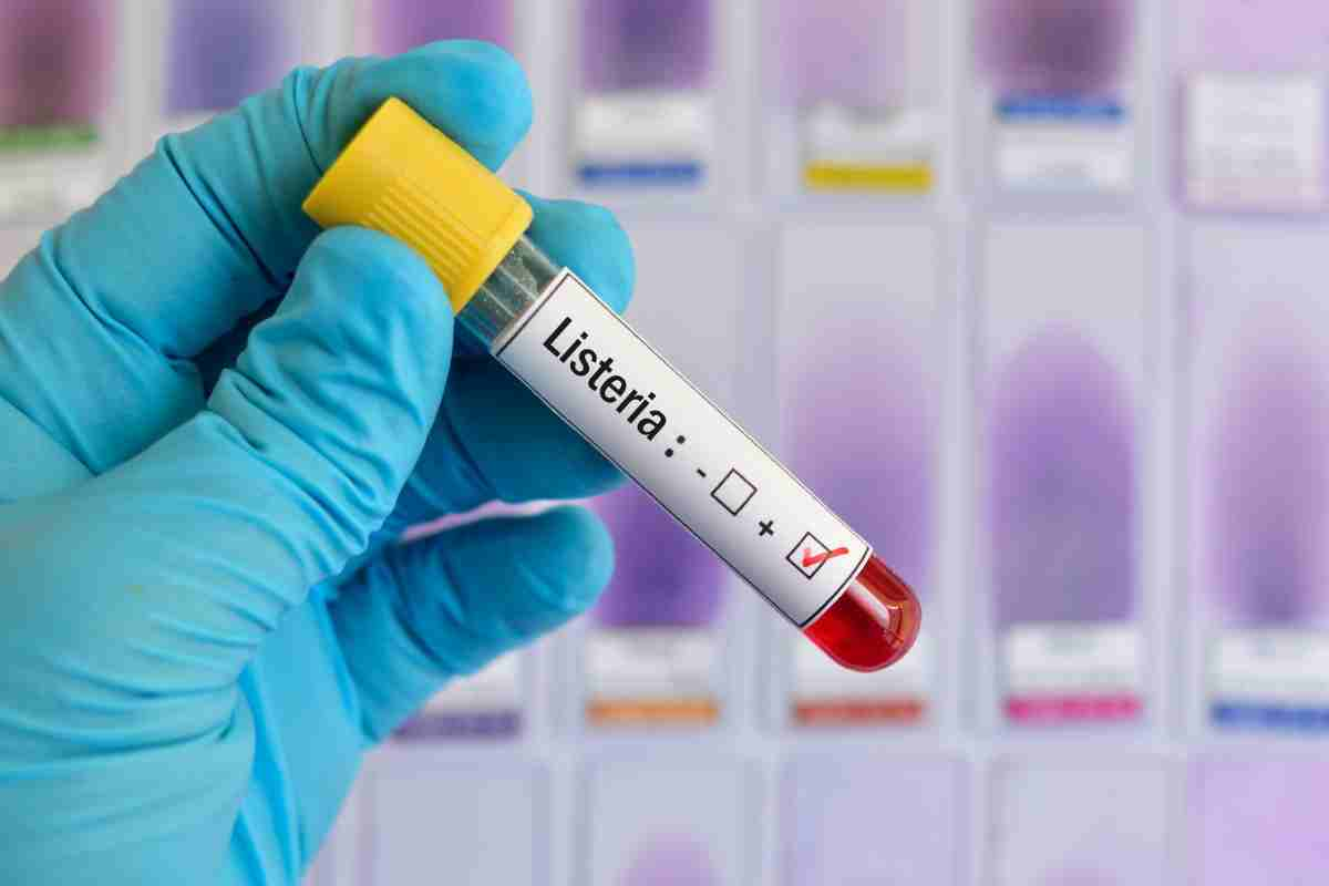 Come prevenire la contaminazione da listeria